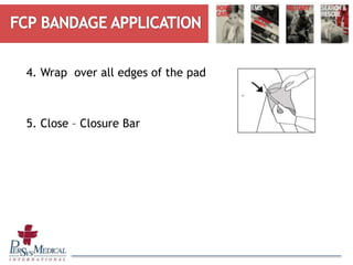 4. Wrap over all edges of the pad
5. Close – Closure Bar
 