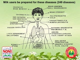 Milk users be prepared for these diseases (249 diseases)
 
