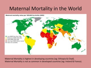 Maternal Mortality in the World
Maternal Mortality is highest in developing countries (eg: Ethiopia & Chad).
Maternal Mortality is not as common in developed countries (eg: Ireland & France).
 