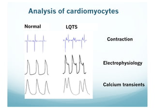 Contraction
Electrophysiology
Calcium transients
Normal LQTS
Analysis of cardiomyocytes
 