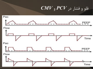متغییرائی که موجب ترایگر می شوند ونتیلاتور چگونه می فهمد که موقع دم رسیده است؟ زمان: CMV 