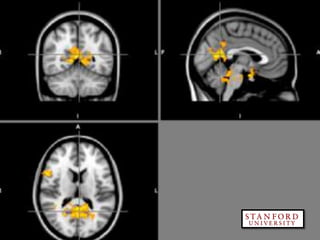 @rogerdooley #brainfluence   Copyright 2013, Dooley Direct LLC
 