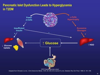 30
Pancreatic Islet Dysfunction Leads to Hyperglycemia
in T2DM
↑ Glucose
Fewer
b-Cells
a-Cells
Hypertrophy
Insufficient
Insulin
Excessive
Glucagon
–
+
↓ Glucose
Uptake
↑ HGO
+
HGO=hepatic glucose output
Adapted from Ohneda A, et al. J Clin Endocrinol Metab. 1978; 46: 504–510; Gomis R, et al. Diabetes Res Clin Pract. 1989; 6: 191–198.
 