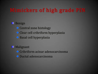 Mimickers of high grade PIN
Benign
Central zone histology
Clear cell cribriform hyperplasia
Basal cell hyperplasia
Malignant
Cribriform acinar adenocarcinoma
Ductal adenocarcinoma
 