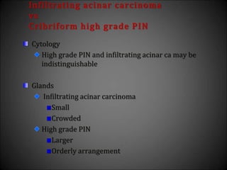 Cytology
High grade PIN and infiltrating acinar ca may be
indistinguishable
Glands
Infiltrating acinar carcinoma
Small
Crowded
High grade PIN
Larger
Orderly arrangement
Infiltrating acinar carcinoma
vs
Cribriform high grade PIN
 