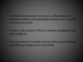 • Various histoanatomic structures , inflammatory &
reactive condition and pathological lesions can resemble
carcinoma prostate.
• Present with problem if there is limited sampling in thin
core needle bx.
• So it is prudent to consider various other pattern before
considering a diagnosis of ca prostate.
 