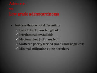 Adenosis
vs
Low grade adenocarcinoma
• Features that do not differentiate
 Back to back crowded glands
 Intraluminal crystalloids
 Medium sized [<3µ] nucleoli
 Scattered poorly formed glands and single cells
 Minimal infiltration at the periphery
 