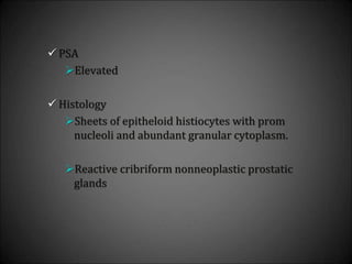  PSA
Elevated
 Histology
Sheets of epitheloid histiocytes with prom
nucleoli and abundant granular cytoplasm.
Reactive cribriform nonneoplastic prostatic
glands
 