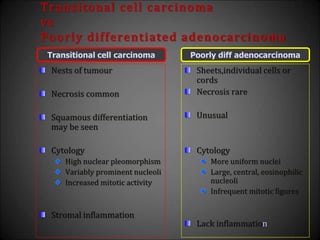 Transitonal cell carcinoma
vs
Poorly differentiated adenocarcinoma
Nests of tumour
Necrosis common
Squamous differentiation
may be seen
Cytology
High nuclear pleomorphism
Variably prominent nucleoli
Increased mitotic activity
Stromal inflammation
Sheets,individual cells or
cords
Necrosis rare
Unusual
Cytology
More uniform nuclei
Large, central, eosinophilic
nucleoli
Infrequent mitotic figures
Lack inflammation
Transitional cell carcinoma Poorly diff adenocarcinoma
 