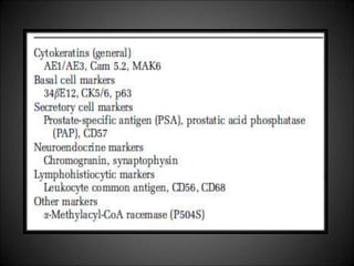 • However ancillary immunohistochemical studies
aimed at identifying prostatic basal cells, prostatic
secretory cells , neuroendocrine cells and
inflammatory cells may be required to resolve a
diagnostic dilemma
• The new marker a-methylacyl-CoA racemase
(P504S) appears to be of value in supporting a
diagnosis of adenocarcinoma,especially when one is
dealing with small foci.
 