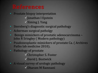References
• Prostate biopsy interpretation
Jonathan I Epstein
Ximing J. Yang
• Sternberg’s diagnostic surgical pathology
• Ackerman surgical patholgy
• Benign mimickers of prostatic adenocarcinoma –
John R Sringley ( Modern pathology)
• Psudoneoplastic mimickers of prostate Ca. ( Archives
Patho lab medicine 2010).
• Pathology of prostate
Christopher S. Foster
David J. Bostwick
• A visual survey of urologic pathology
Dharam M Ramnani
 