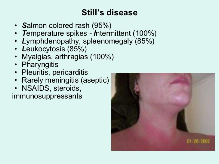 Mimics of infectious_diseases