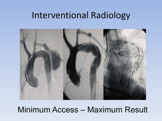 Interventional Radiology Minimum Access – Maximum Result 