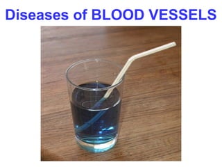 Diseases of BLOOD VESSELS

 