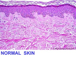 NORMAL SKIN

 