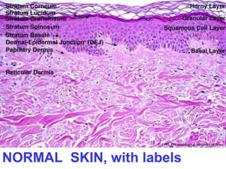 NORMAL SKIN, with labels

 