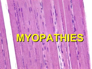 MYOPATHIES

 