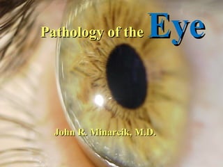 Pathology of the

Eye

John R. Minarcik, M.D.

 