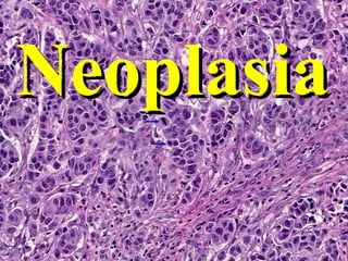 Neoplasia

 