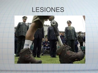 LESIONES  
