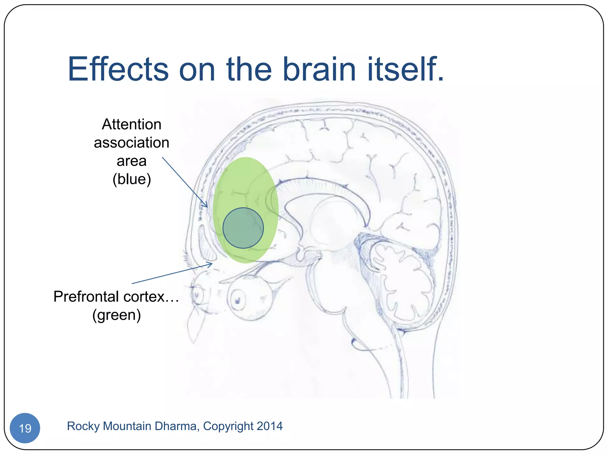 Effects on the brain itself.
Attention
association
area
(blue)

Prefrontal cortex…
(green)

19

Rocky Mountain Dharma, Copyright 2014

 