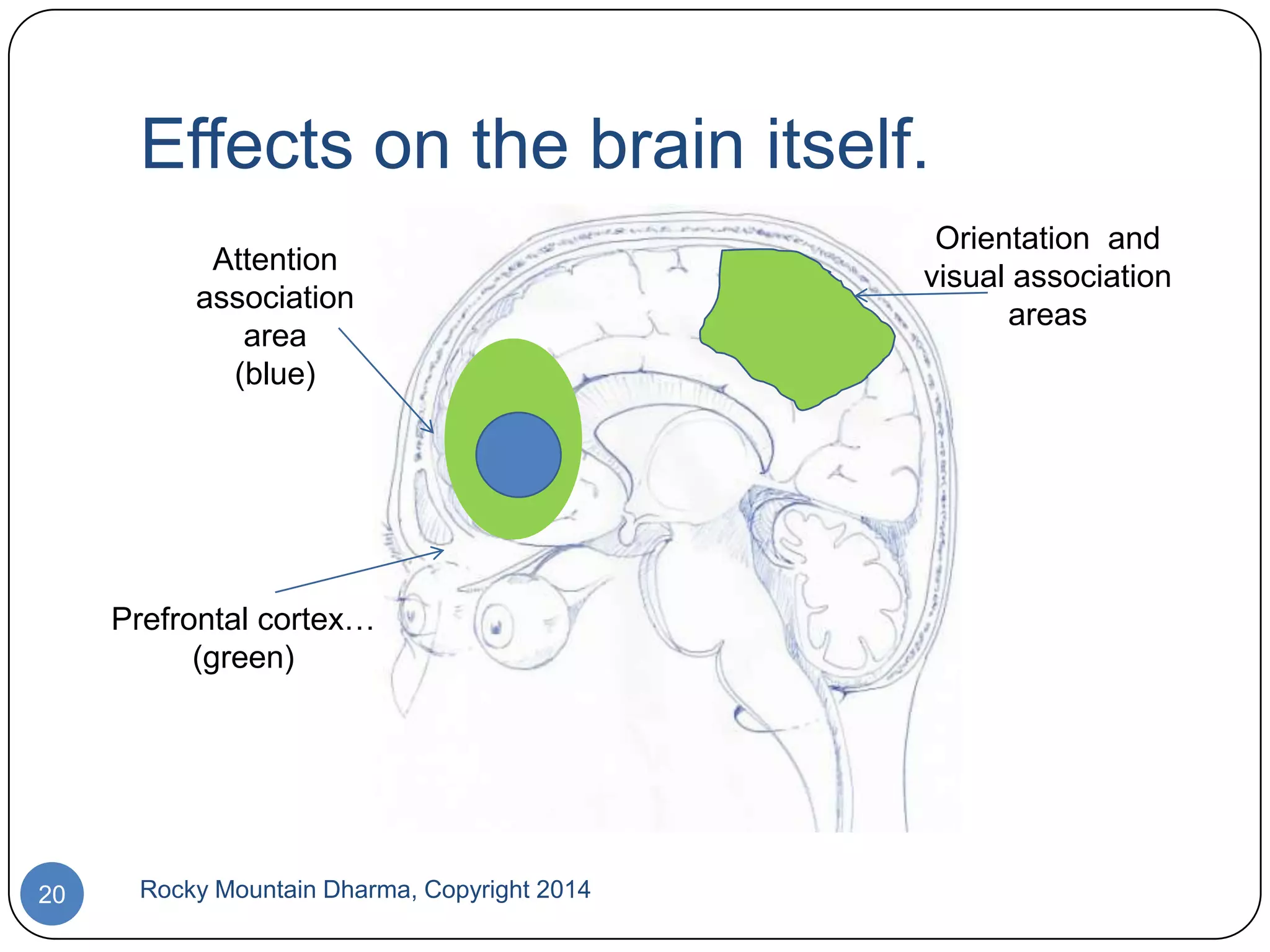 Effects on the brain itself.
Attention
association
area
(blue)

Prefrontal cortex…
(green)

20

Rocky Mountain Dharma, Copyright 2014

Orientation and
visual association
areas

 