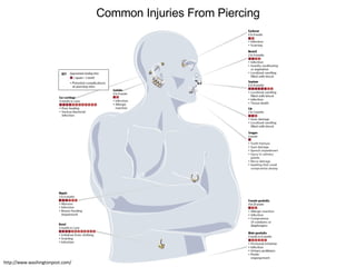 http://www.washingtonpost.com/ Common Injuries From Piercing 