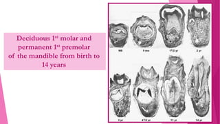 Deciduous 1st molar and
permanent 1st premolar
of the mandible from birth to
14 years
 