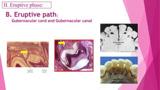 B. Eruptive path:
Gubernacular cord and Gubernacular canal
II. Eruptive phase:II. Eruptive phase:
 