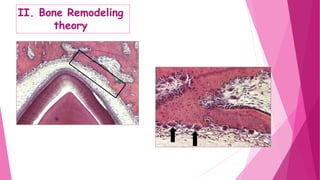 II. Bone Remodeling
theory
 