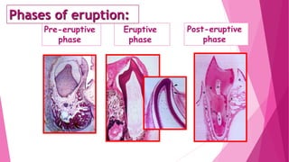 Pre-eruptive
phase
Eruptive
phase
Post-eruptive
phase
Phases of eruption:
 