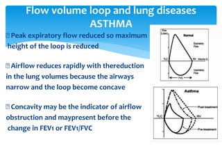 Peak expiratory flow reduced so maximum
height of the loop is reduced
Airflow reduces rapidly with thereduction
in the lung volumes because the airways
narrow and the loop become concave
Concavity may be the indicator of airflow
obstruction and maypresent before the
change in FEV1 or FEV1/FVC
Flow volume loop and lung diseases
ASTHMA
 