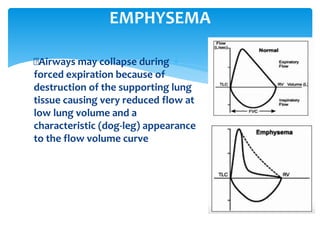 Airways may collapse during
forced expiration because of
destruction of the supporting lung
tissue causing very reduced flow at
low lung volume and a
characteristic (dog‐leg) appearance
to the flow volume curve
EMPHYSEMA
 