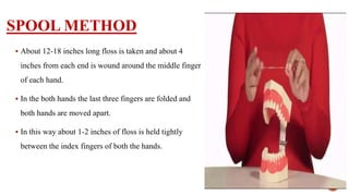 PLAQUE CONTROL | PPTX