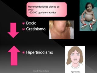  Bocio
 Cretinismo
 Hipertiriodismo
Recomendaciones diarias de
yodo:
100-200 µg/día en adultos
Hosp. Dr.Alejandro Cabral
 