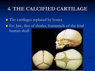 BONE  MARROW Occupies cavities between trabellaeYellow marrow – a reticulum of connective tissue  fibers that support blood vessels, nerve fibers, adipose tissuesRed Marrow – (Hemopoietic Bone)       - site of RBC and Some type of WBC                   production- ex. Flat bones