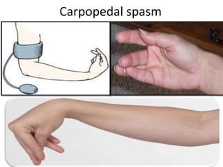 Carpopedal spasm
 