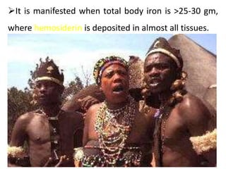 It is manifested when total body iron is >25-30 gm,
where hemosiderin is deposited in almost all tissues.
 