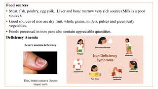Food sources
• Meat, fish, poultry, egg yolk. Liver and bone marrow very rich source (Milk is a poor
source).
• Good sources of iron are dry fruit, whole grains, millets, pulses and green leafy
vegetables.
• Foods processed in iron pans also contain appreciable quantities.
Deficiency Anemia
Severe anemia deficiency
Thin, brittle concave (Spoon
shape) nails
 