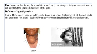 Food sources Sea foods, food additives used as bread dough oxidizers or conditioners
can contribute to the iodine content of the diet.
Deficiency Hypothyroidism
Iodine Deficiency Disorder collectively known as goiter (enlargement of thyroid glad)
and cretinism (children)- declined brain development (mental retardation) and growth.
Goiter
 