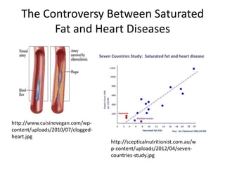 The Controversy Between Saturated
         Fat and Heart Diseases




http://www.cuisinevegan.com/wp-
content/uploads/2010/07/clogged-
heart.jpg
                                   http://scepticalnutritionist.com.au/w
                                   p-content/uploads/2012/04/seven-
                                   countries-study.jpg
 