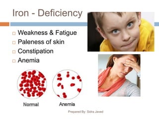 Iron - Deficiency
 Weakness & Fatigue
 Paleness of skin
 Constipation
 Anemia
Prepared By: Sidra Javed
 