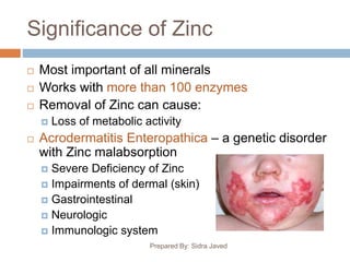 Significance of Zinc
Prepared By: Sidra Javed
 Most important of all minerals
 Works with more than 100 enzymes
 Removal of Zinc can cause:
 Loss of metabolic activity
 Acrodermatitis Enteropathica – a genetic disorder
with Zinc malabsorption
 Severe Deficiency of Zinc
 Impairments of dermal (skin)
 Gastrointestinal
 Neurologic
 Immunologic system
 