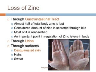 Loss of Zinc
Prepared By: Sidra Javed
 Through Gastrointestinal Tract
 Almost half of total body zinc is lost
 Considered amount of zinc is secreted through bile
 Most of it is reabsorbed
 An important point in regulation of Zinc levels in body
 Through Urine
 Through surfaces
 Desquamated skin
 Hairs
 Sweat
 