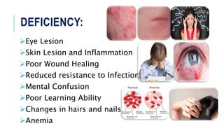 DEFICIENCY:
Eye Lesion
Skin Lesion and Inflammation
Poor Wound Healing
Reduced resistance to Infections
Mental Confusion
Poor Learning Ability
Changes in hairs and nails
Anemia
 
