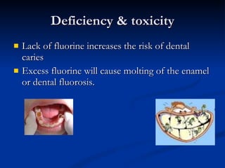 Deficiency & toxicity Lack of fluorine increases the risk of dental caries Excess fluorine will cause molting of the enamel or dental fluorosis.  