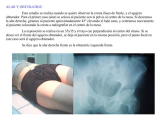 ALAR Y OBTURATRIZ: Este estudio se realiza cuando se quiere observar la cresta ilíaca de frente, y el agujero obturador. Para el primer caso (alar) se coloca al paciente con la pelvis al centro de la mesa. Si deseamos la alar derecha, giramos al paciente aproximadamente 45° elevando el lado sano, y centramos nuevamente al paciente colocando la cresta a radiografiar en el centro de la mesa. La exposición se realiza en un 35x35 y el rayo cae perpendicular al centro del chasis. Si se desea ver el frente del agujero obturador, se deja al paciente en la misma posición, pero el punto focal en este caso será el agujero obturador. Se dice que la alar derecha frente es la obturatriz izquierda frente. 