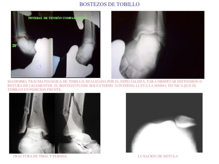 ManualRx07 MiembroInferior
