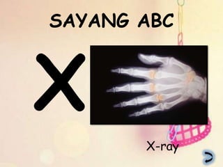 SAYANG ABC




       X-ray
 