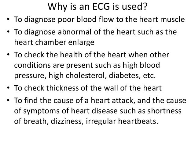 Electrocardiogram Ecg Or Ekg